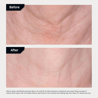 Revision Skincare Nectifirm Reafirmante Cuello y Mandíbula 48ml